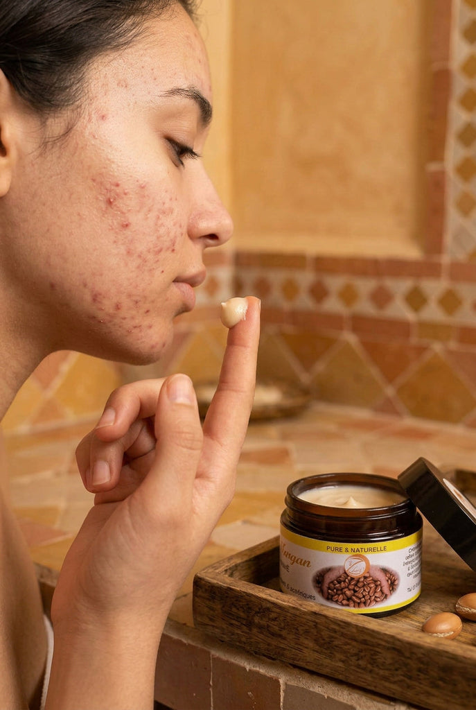 Le carnet de Zohra : la crème Argan anti-acné